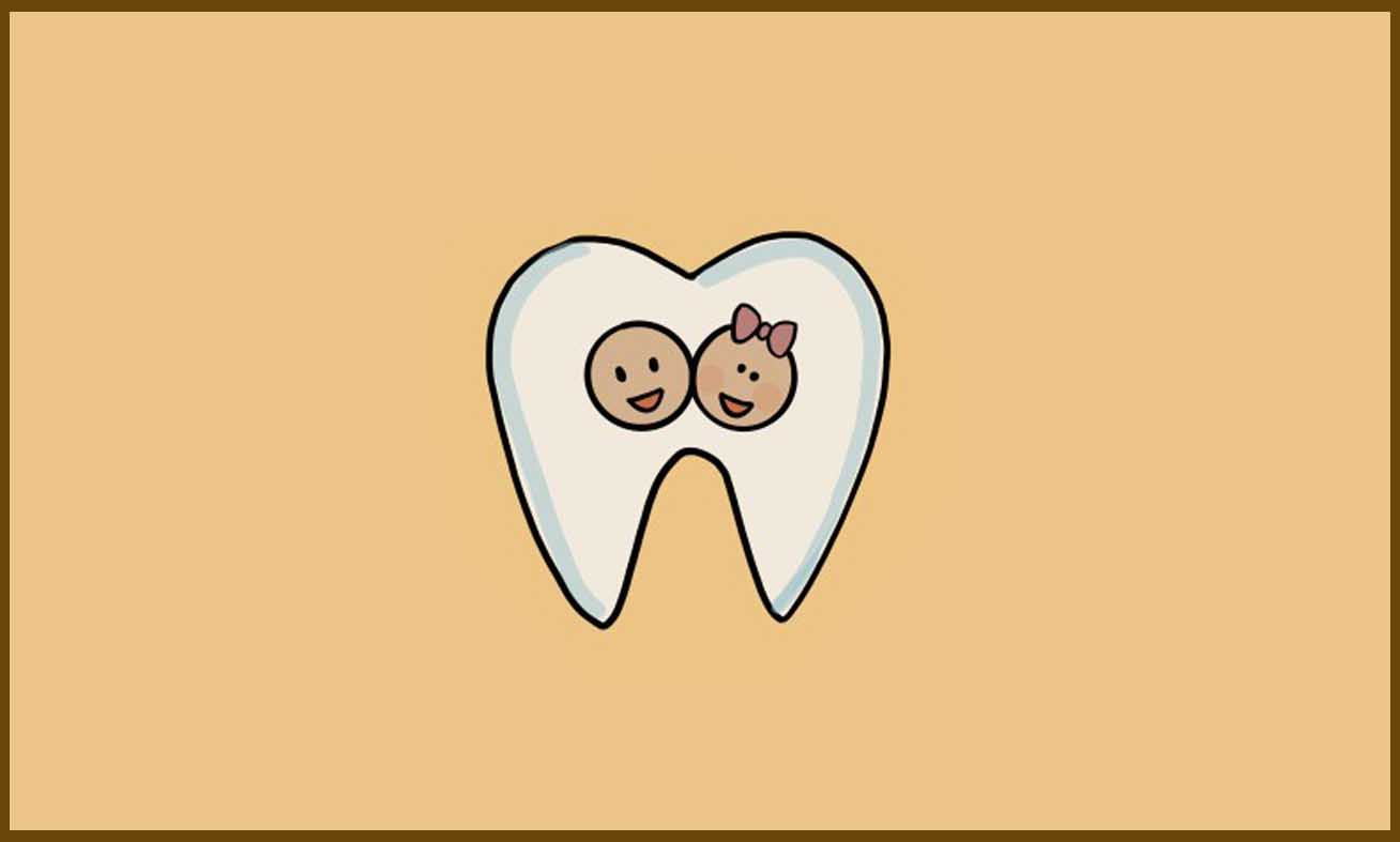 braces for teeth