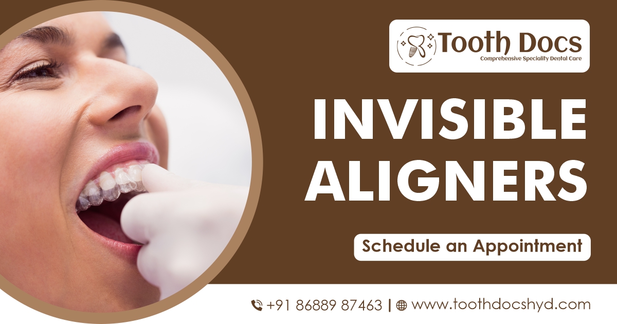 Invisible Braces in Hyderabad